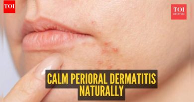 पेरीओरल डर्माटायटीसचा सामना करण्यासाठी 5 नैसर्गिक घरगुती उपचार
