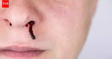 तुम्ही शिंकल्यावर तुमच्या नाकातून रक्त का येते आणि ते कसे थांबवायचे: सामान्य कारणे, जोखीम आणि उपचार |