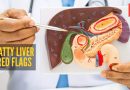 फॅटी लिव्हर लक्षणे: हार्वर्ड-प्रशिक्षित डॉक्टर फॅटी यकृताची चेतावणी चिन्हे सूचीबद्ध करतात जी कधीही चुकवू नयेत |