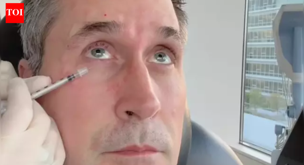 बोटॉक्स फक्त एका बाजूला: डॉक्टरांनी नवऱ्याच्या अर्ध्या चेहऱ्यावर टोचले आधी आणि नंतर ‘धक्कादायक’ |