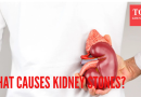 पाण्याच्या कमतरतेपेक्षा जास्त: किडनी स्टोन कशामुळे होतात आणि त्यावर उपचार कसे केले जातात