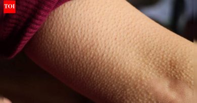 हा ‘निरुपयोगी’ शरीराचा भाग मानवांना हंस का होतो आणि त्वचा आणि केसांच्या आरोग्यामध्ये त्याची आश्चर्यकारक भूमिका स्पष्ट करते.