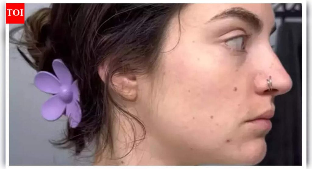 स्त्रीने 30 दिवस अल्कोहोल सोडले, तिच्या त्वचेचे आश्चर्यकारक परिवर्तन सामायिक केले; ‘सवय सोडणे कठीण आहे…’