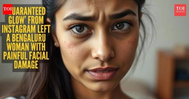 बंगळुरूच्या महिलेचे म्हणणे आहे की इंस्टाग्राम ब्युटी ट्रीटमेंटमुळे तिचा चेहरा जळला आणि सुजला