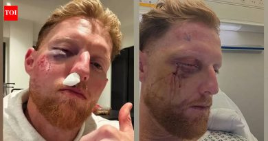 बेन स्टोक्सच्या चेहऱ्यावर शस्त्रक्रिया करण्यात आली विचित्र जाळी, इंग्लंडच्या कर्णधाराने शेअर केला फोटो